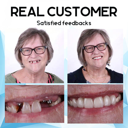 👩‍⚕️Seagril™ Silicone Reline Denture Set🦷