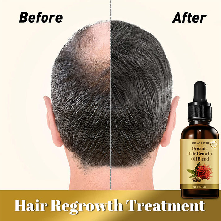 ✨SEAGRIL™ Organic hair growth oil blend