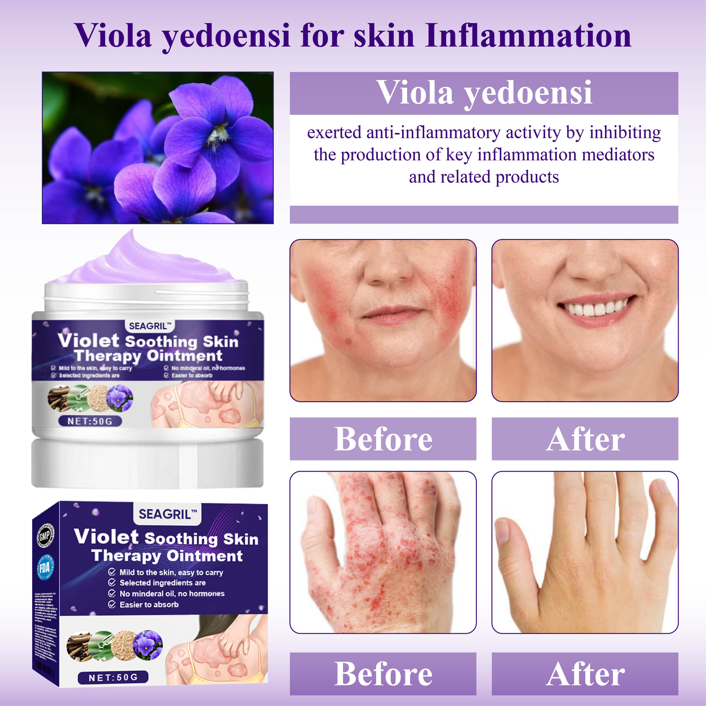 SEAGRIL™ Violet Soothing Skin Therapy Ointment